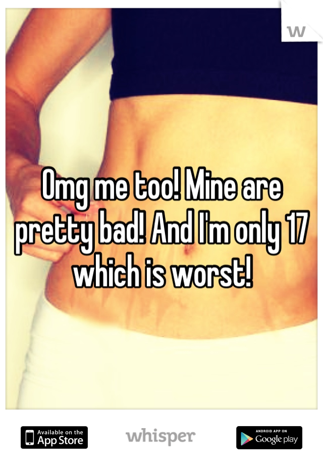 Omg me too! Mine are pretty bad! And I'm only 17 which is worst!