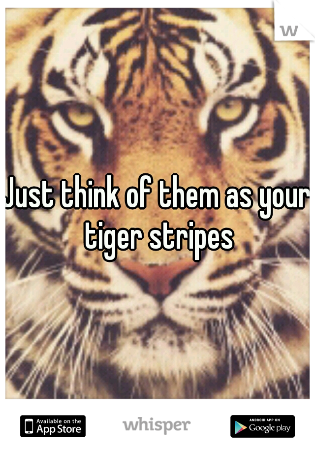 Just think of them as your tiger stripes