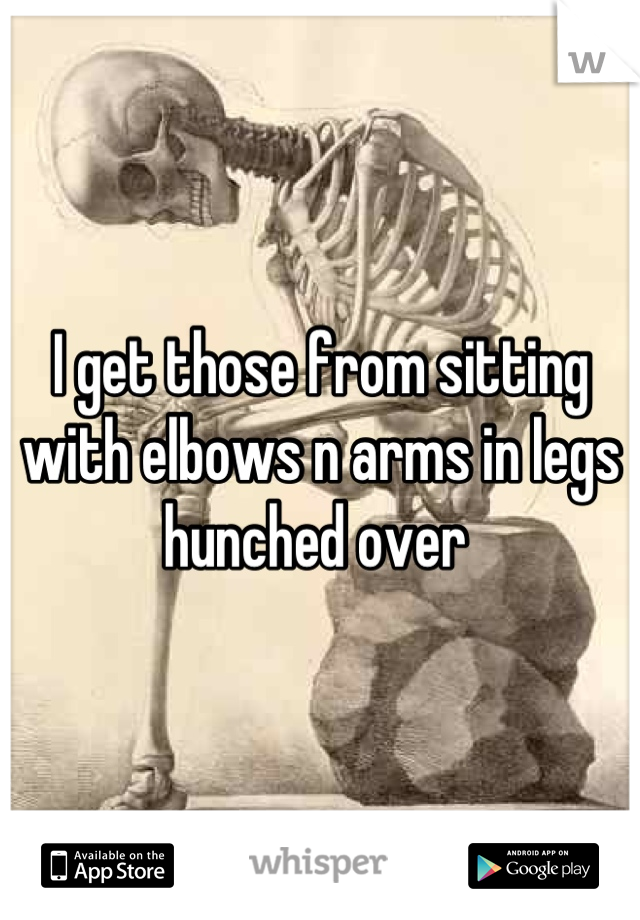 I get those from sitting with elbows n arms in legs hunched over 