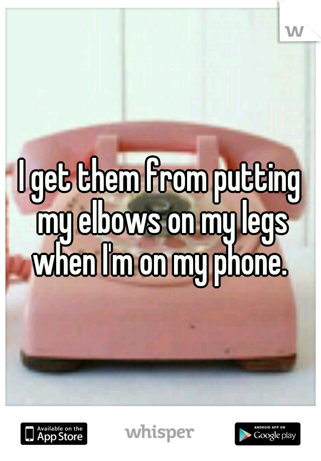 I get them from putting my elbows on my legs when I'm on my phone. 