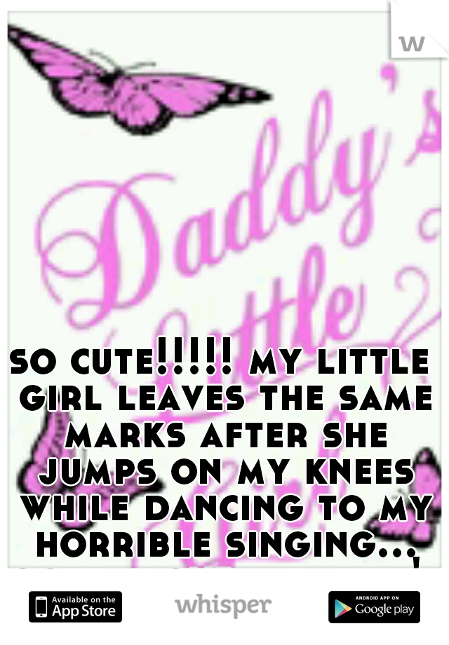 so cute!!!!! my little girl leaves the same marks after she jumps on my knees while dancing to my horrible singing... gotta love a daddy's girl!