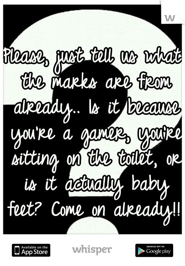 Please, just tell us what the marks are from already.. Is it because you're a gamer, you're sitting on the toilet, or is it actually baby feet? Come on already!!!!