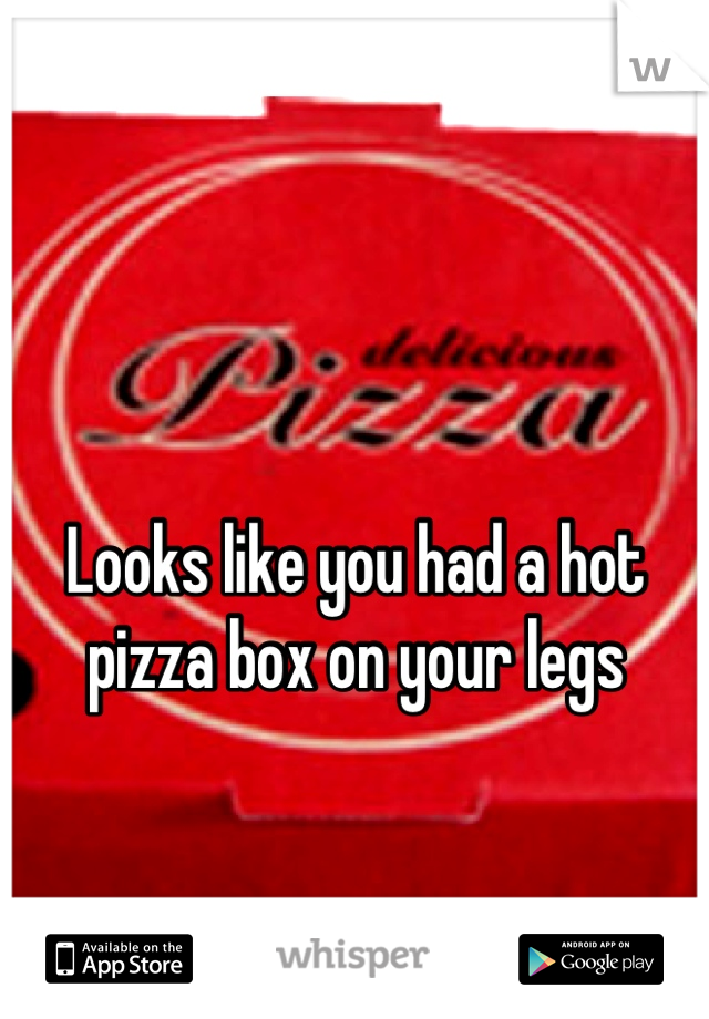 Looks like you had a hot pizza box on your legs