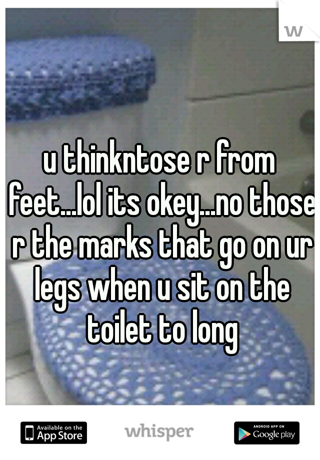 u thinkntose r from feet...lol its okey...no those r the marks that go on ur legs when u sit on the toilet to long