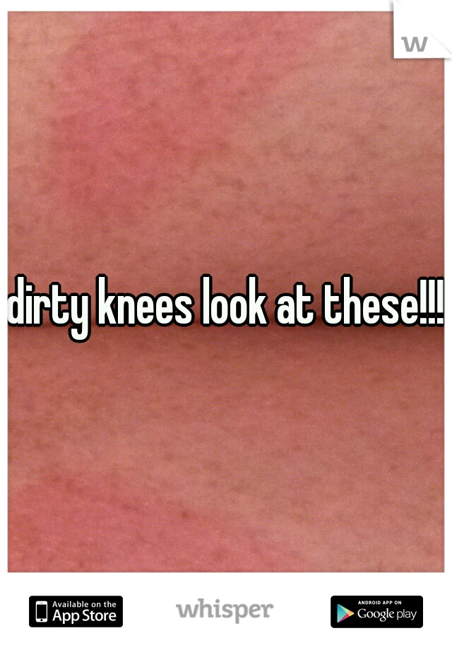 dirty knees look at these!!!