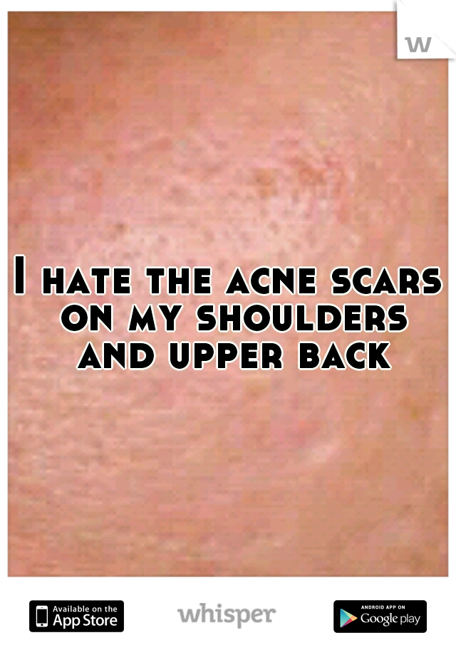 I hate the acne scars on my shoulders and upper back