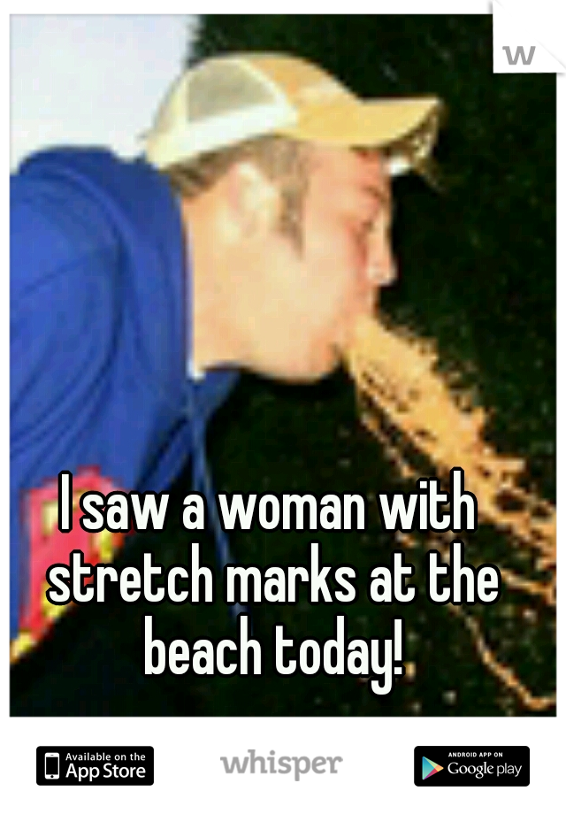 I saw a woman with stretch marks at the beach today!