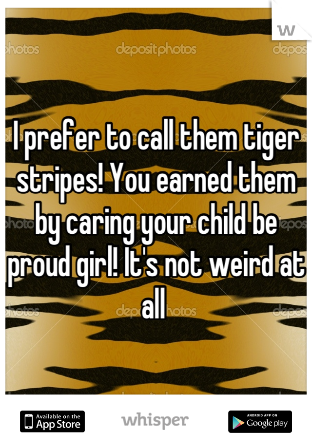 I prefer to call them tiger stripes! You earned them by caring your child be proud girl! It's not weird at all 