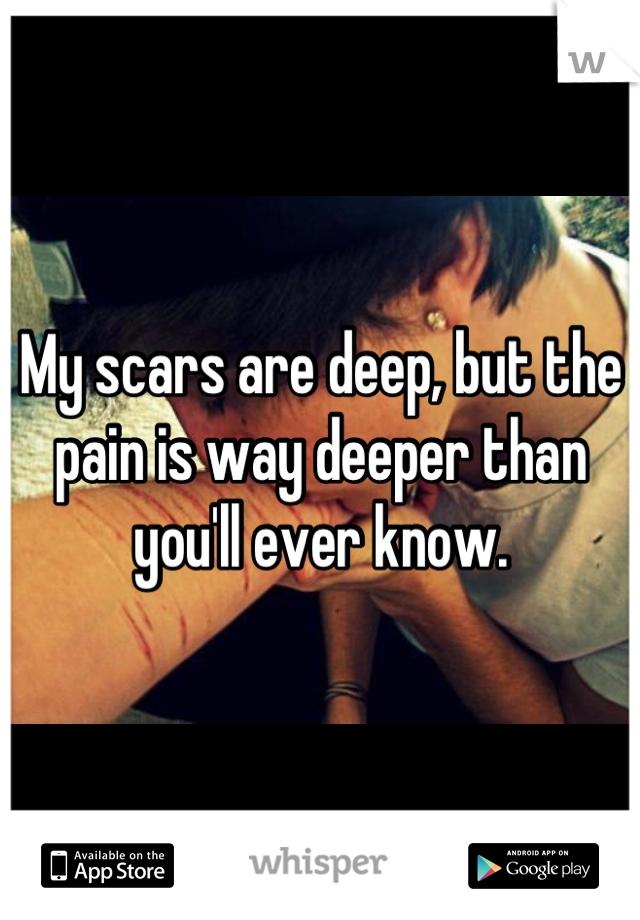 My scars are deep, but the pain is way deeper than you'll ever know.