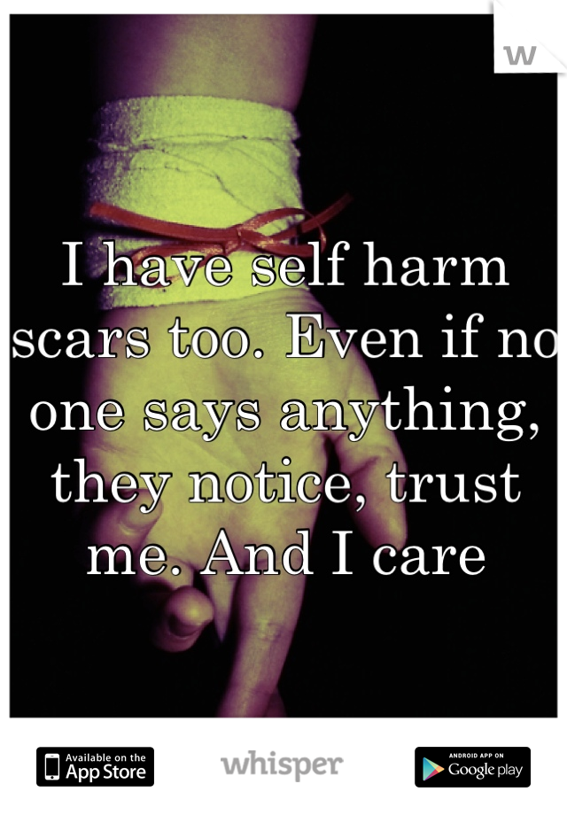 I have self harm scars too. Even if no one says anything, they notice, trust me. And I care
