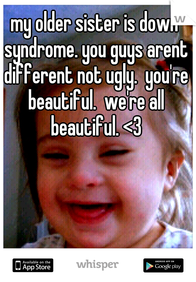 my older sister is down syndrome. you guys arent different not ugly.  you're beautiful.  we're all beautiful. <3