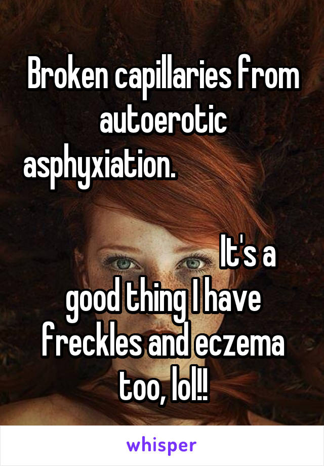 Broken capillaries from autoerotic asphyxiation.                                                                                                 It's a good thing I have freckles and eczema too, lol!!