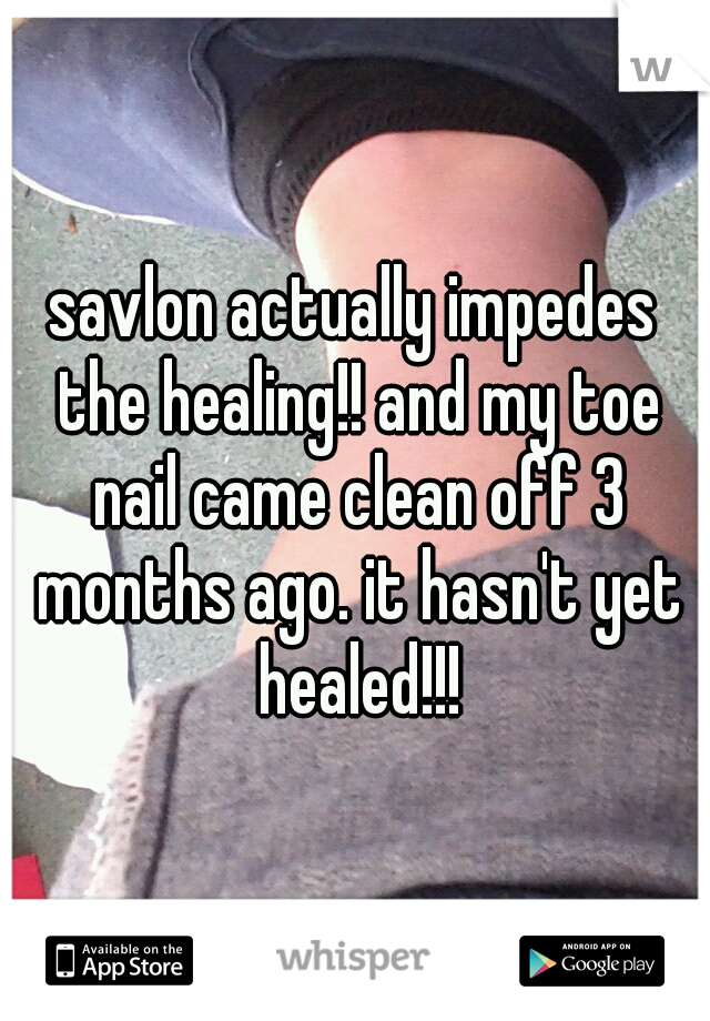 savlon actually impedes the healing!! and my toe nail came clean off 3 months ago. it hasn't yet healed!!!