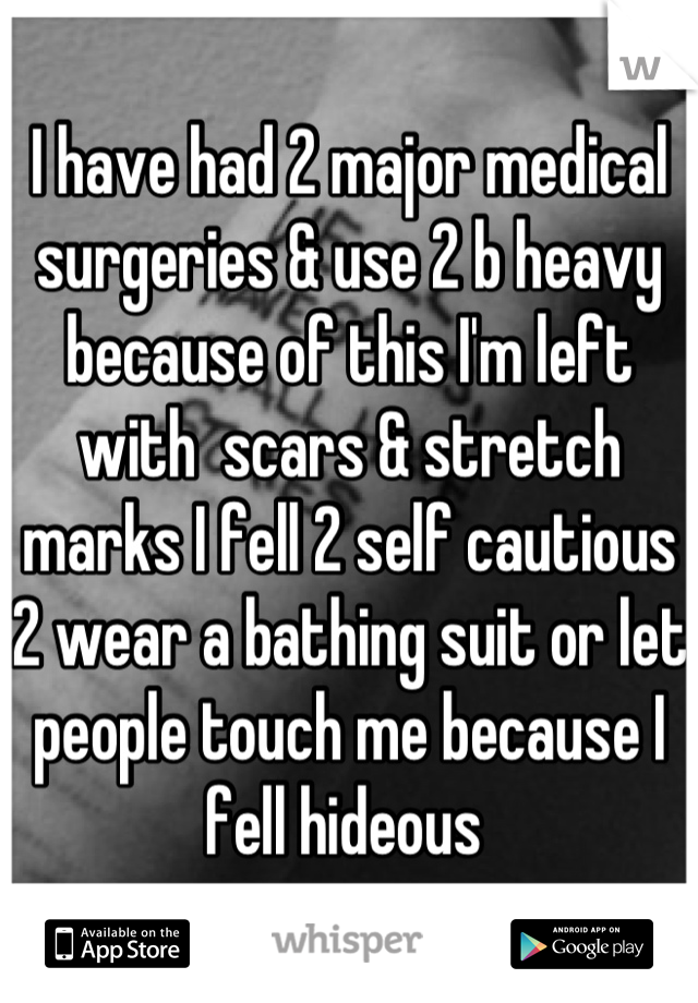 I have had 2 major medical surgeries & use 2 b heavy because of this I'm left with  scars & stretch marks I fell 2 self cautious 2 wear a bathing suit or let people touch me because I fell hideous 