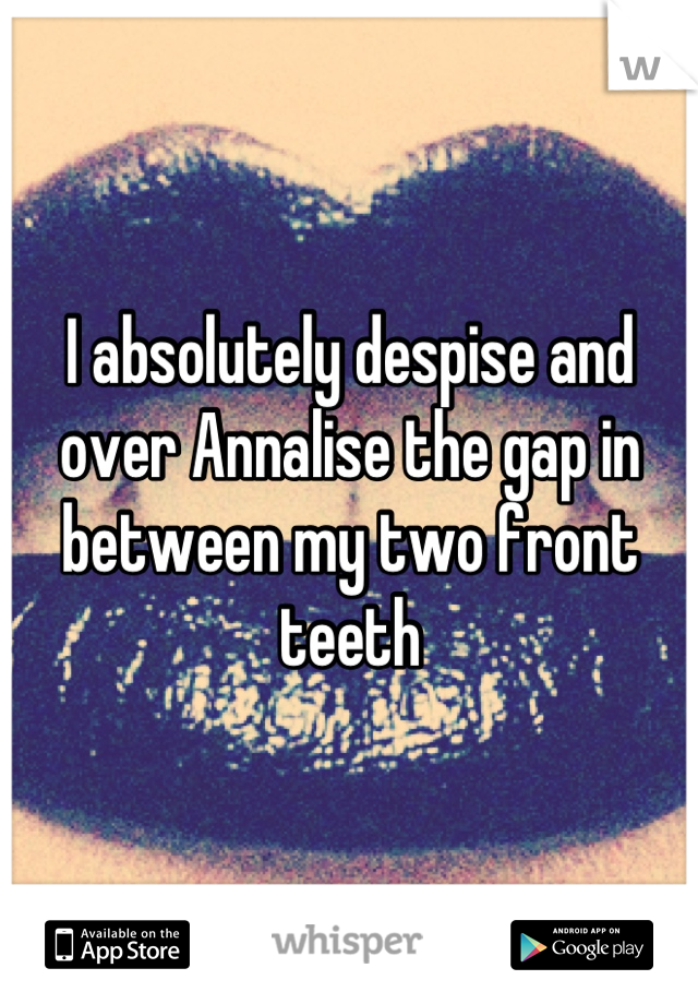 I absolutely despise and over Annalise the gap in between my two front teeth