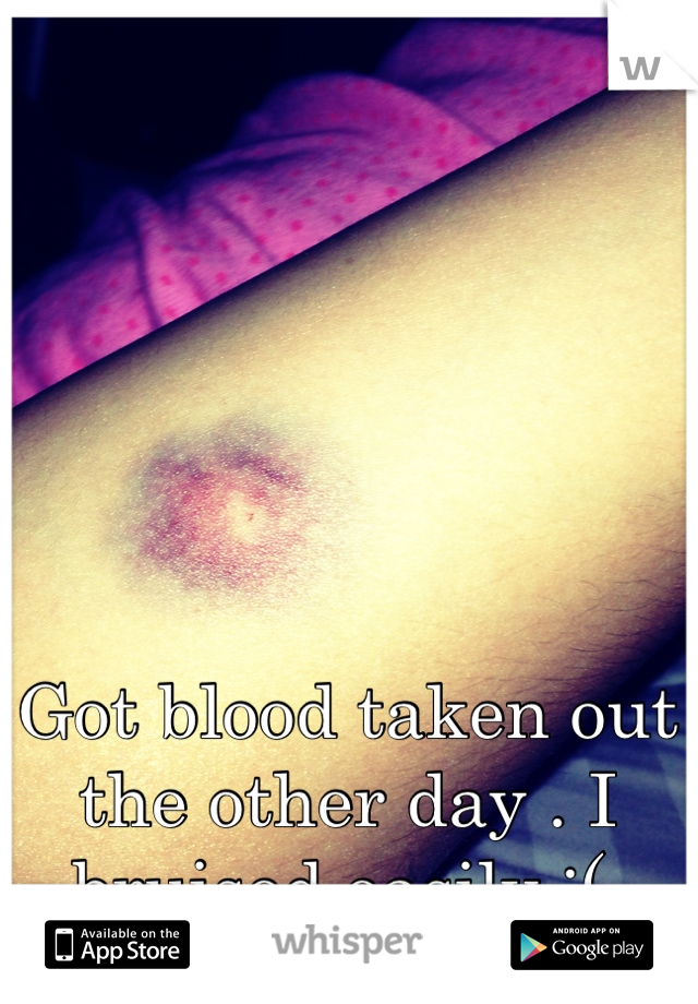 Got blood taken out the other day . I bruised easily :( 