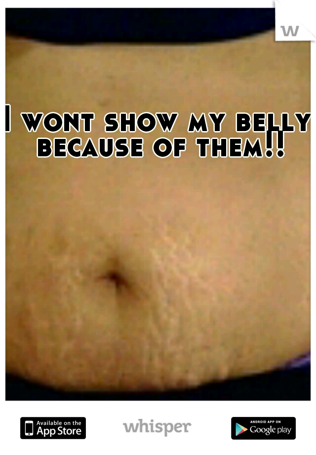 I wont show my belly because of them!!