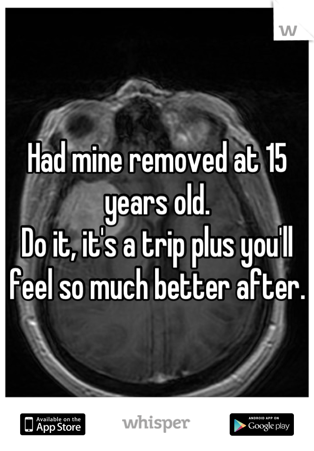 Had mine removed at 15 years old.
Do it, it's a trip plus you'll feel so much better after.