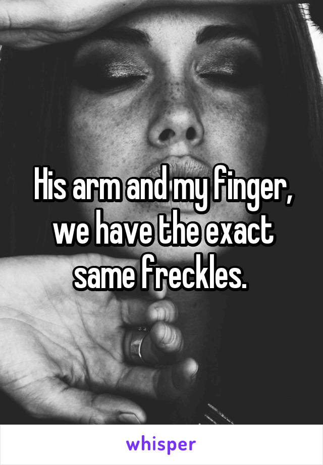 His arm and my finger, we have the exact same freckles. 