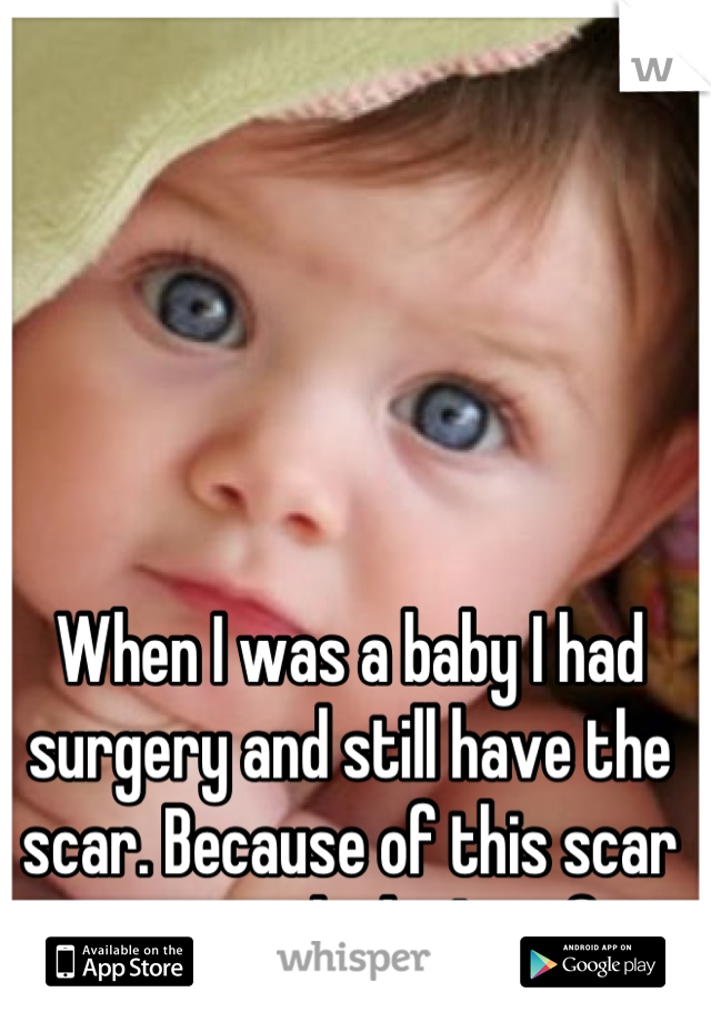 When I was a baby I had surgery and still have the scar. Because of this scar everyone thinks I am fat.