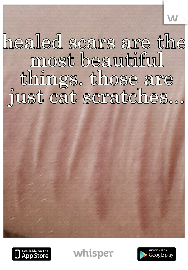 healed scars are the most beautiful things. those are just cat scratches...