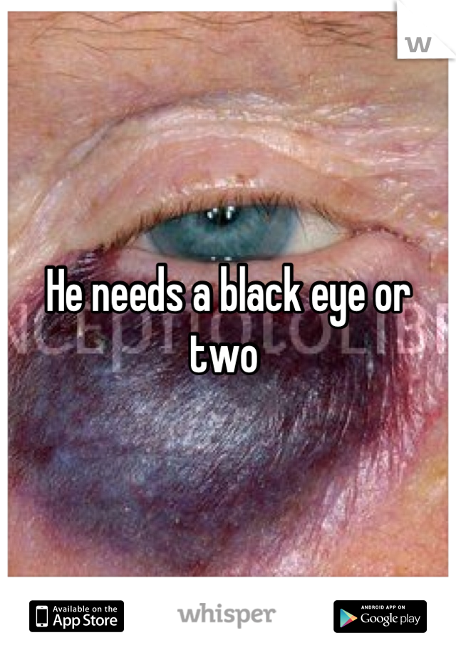 He needs a black eye or two 
