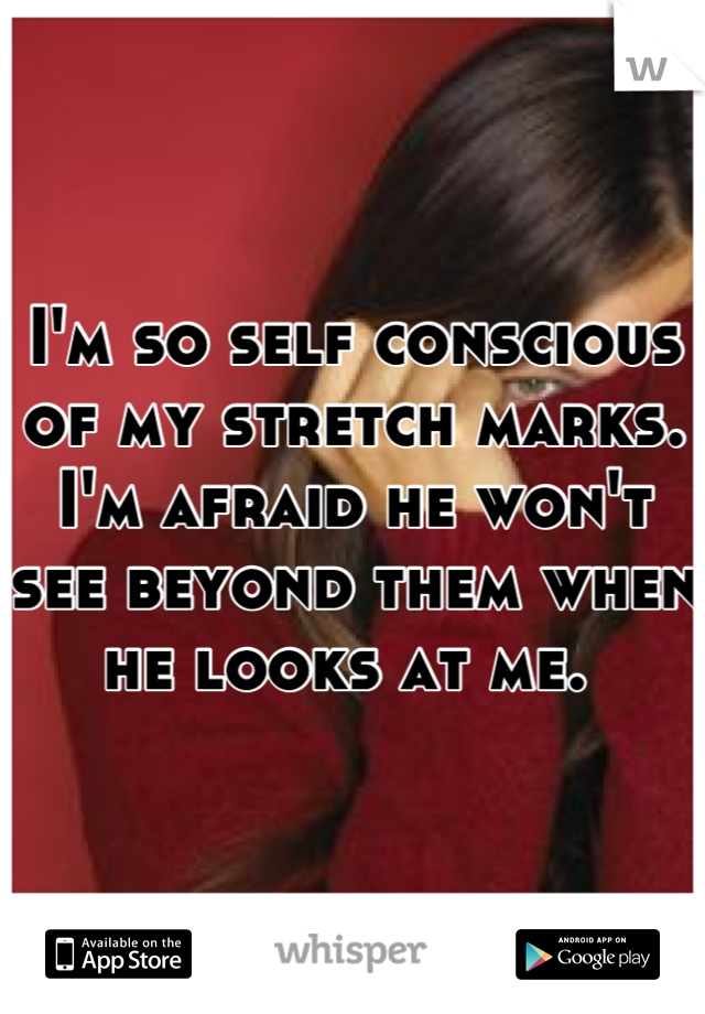 I'm so self conscious of my stretch marks. I'm afraid he won't see beyond them when he looks at me. 