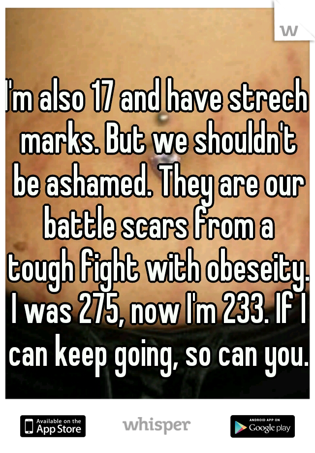 I'm also 17 and have strech marks. But we shouldn't be ashamed. They are our battle scars from a tough fight with obeseity. I was 275, now I'm 233. If I can keep going, so can you.