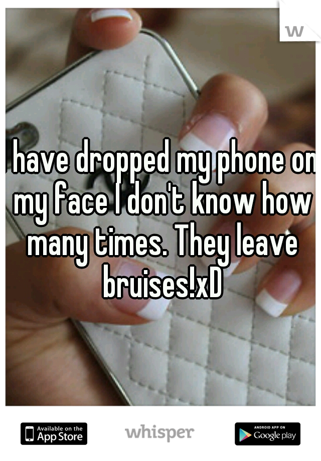 I have dropped my phone on my face I don't know how many times. They leave bruises!xD