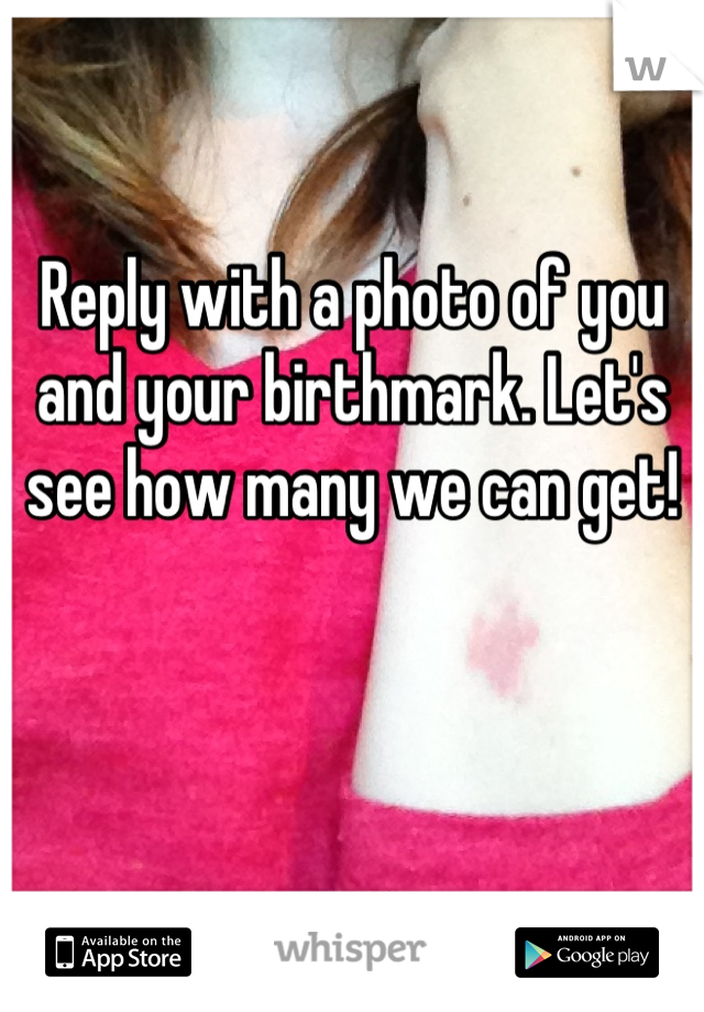 Reply with a photo of you and your birthmark. Let's see how many we can get!