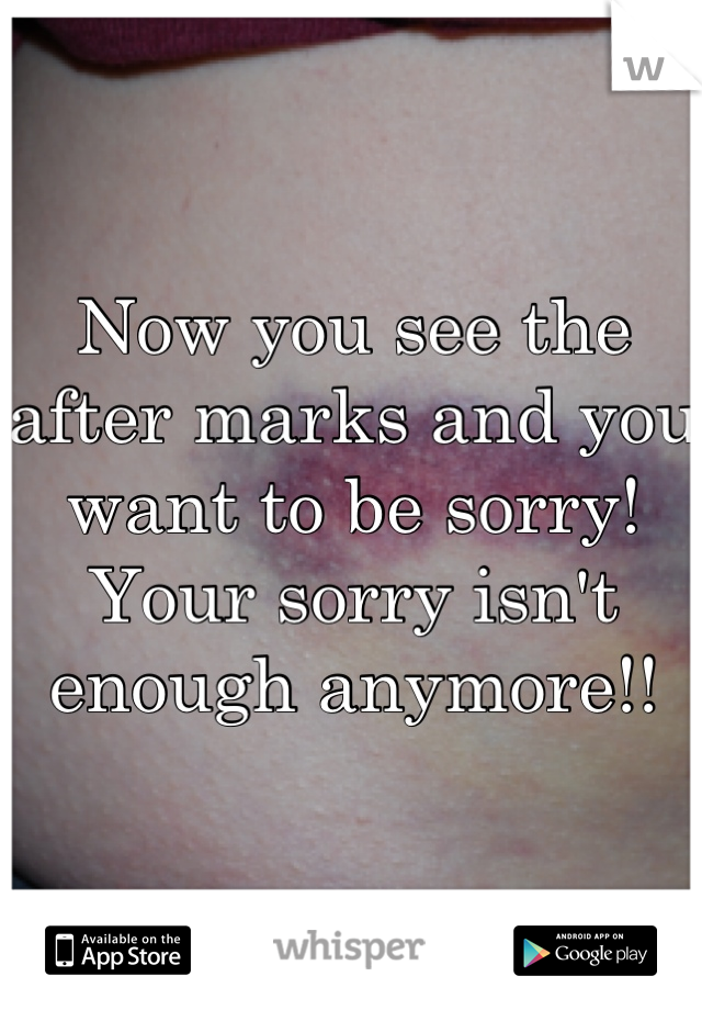 Now you see the after marks and you want to be sorry! Your sorry isn't enough anymore!!