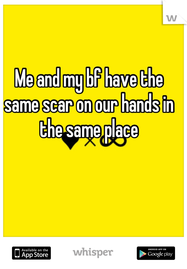 Me and my bf have the same scar on our hands in the same place
