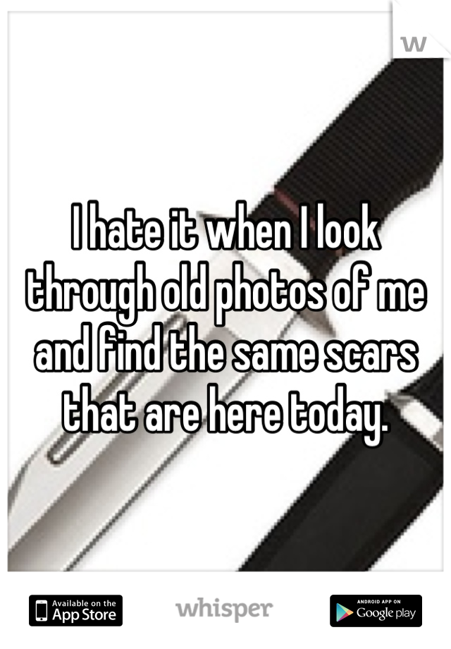 I hate it when I look through old photos of me and find the same scars that are here today.