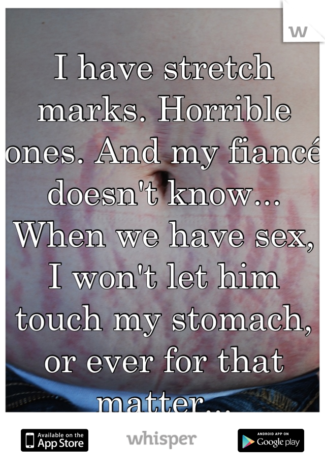 I have stretch marks. Horrible ones. And my fiancé doesn't know... When we have sex, I won't let him touch my stomach, or ever for that matter...