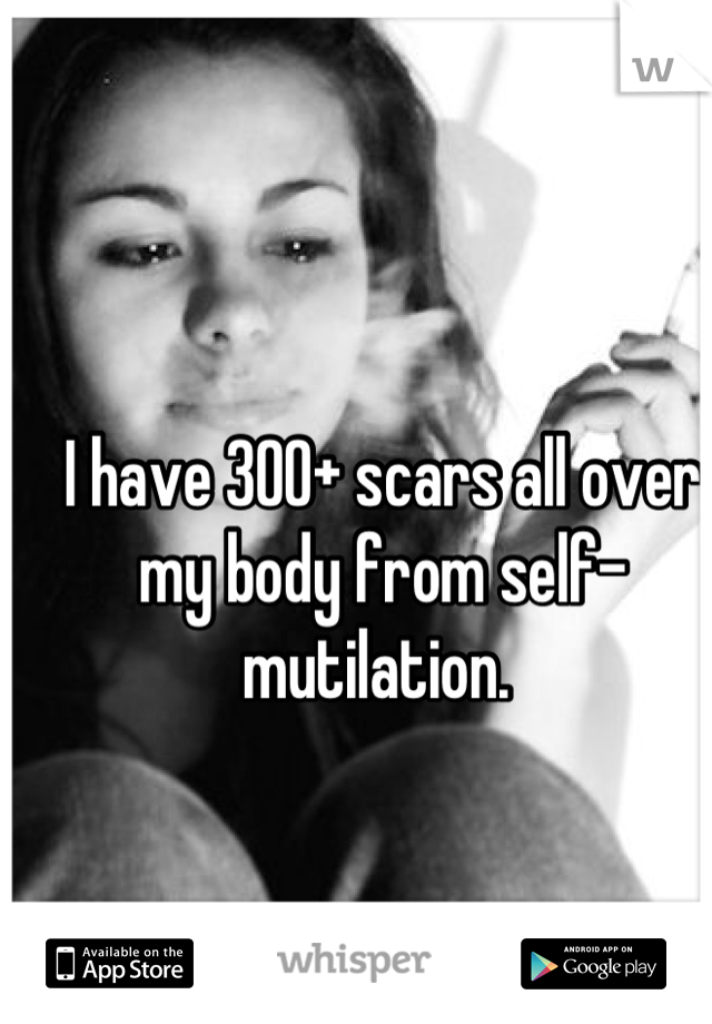 I have 300+ scars all over my body from self-mutilation. 