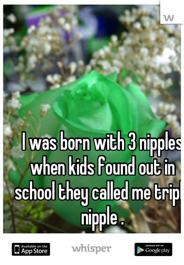I was born with 3 nipples when kids found out in school they called me triple nipple .