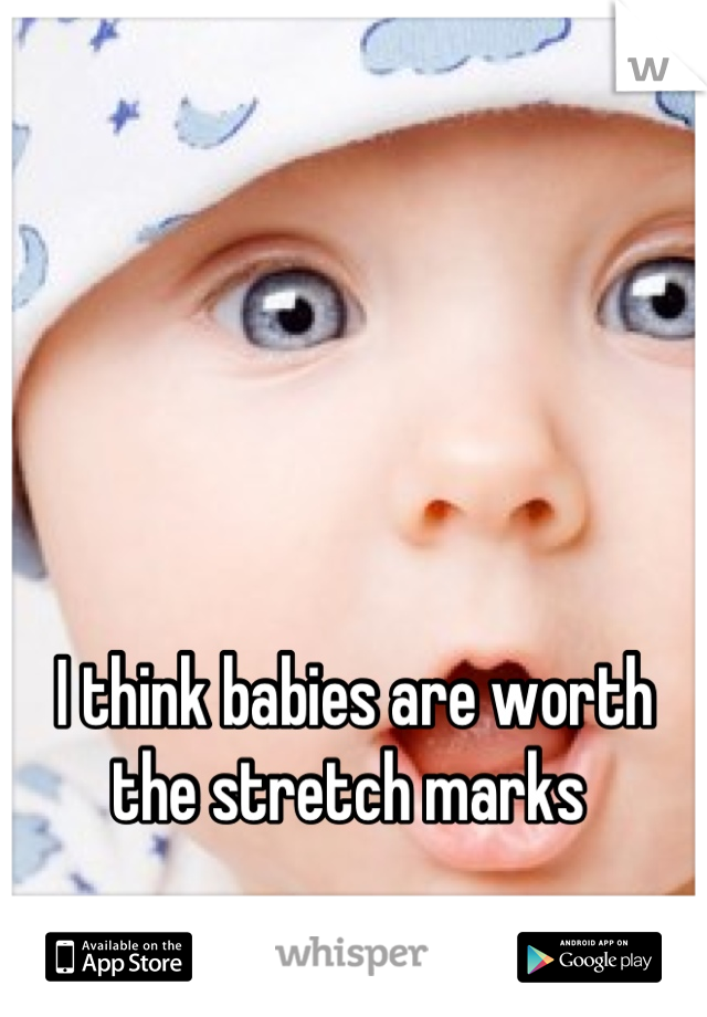 I think babies are worth the stretch marks 