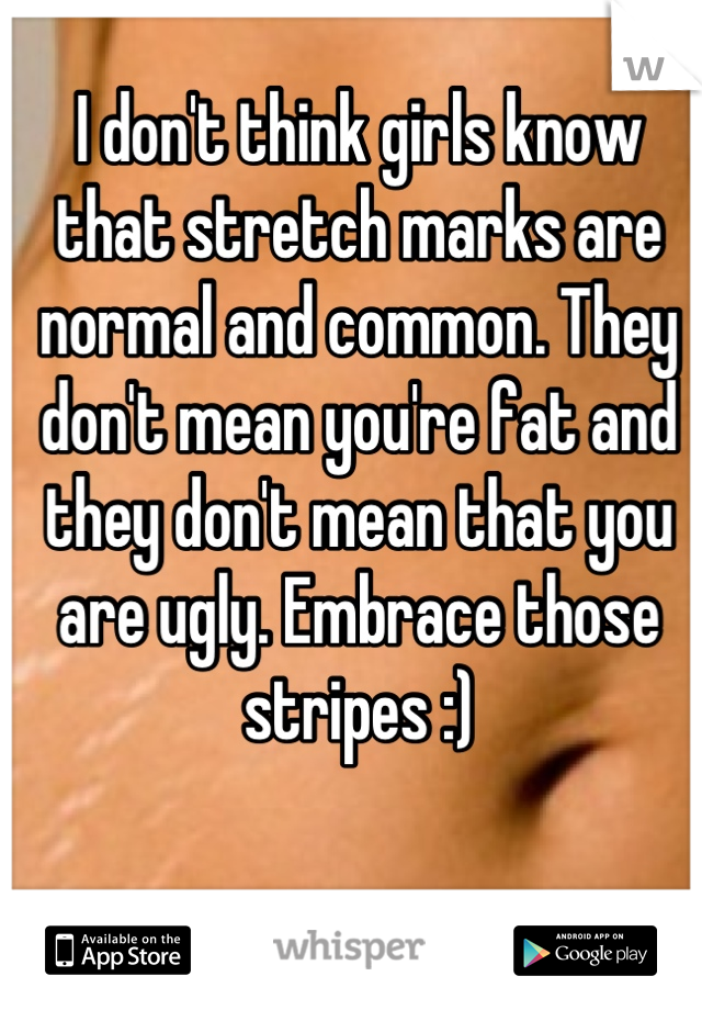 I don't think girls know that stretch marks are normal and common. They don't mean you're fat and they don't mean that you are ugly. Embrace those stripes :)