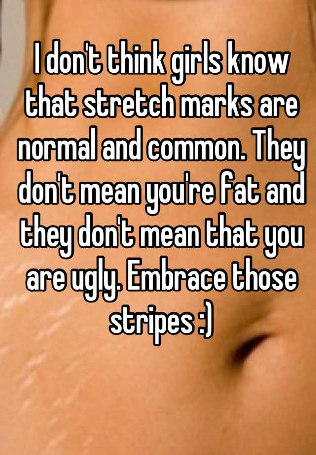 I don't think girls know that stretch marks are normal and common. They don't mean you're fat and they don't mean that you are ugly. Embrace those stripes :)