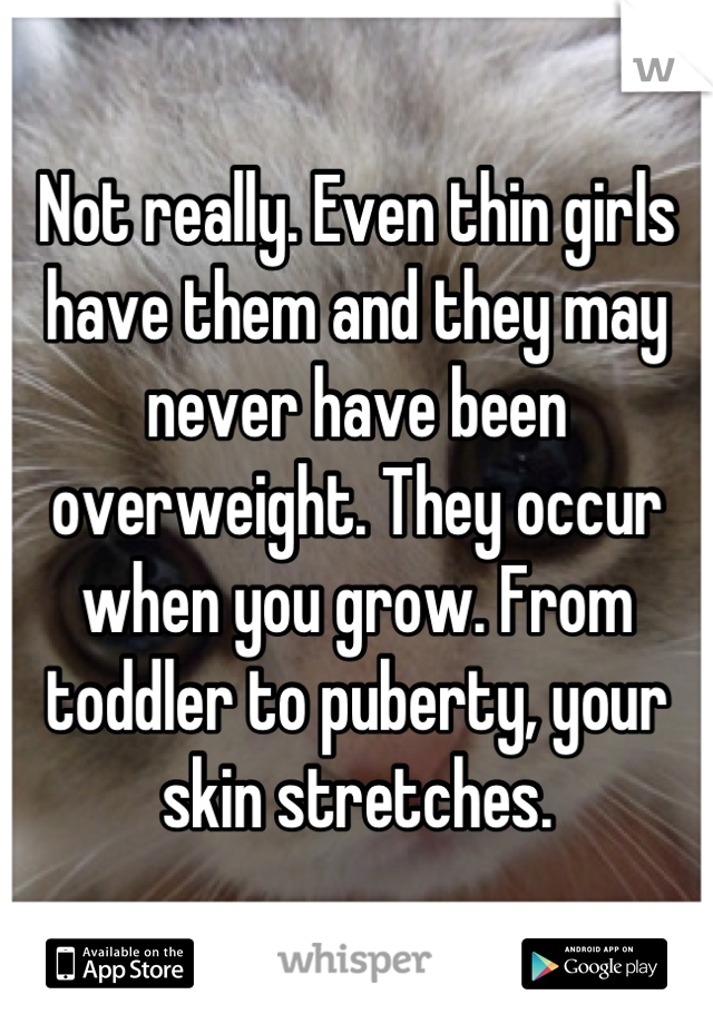 Not really. Even thin girls have them and they may never have been overweight. They occur when you grow. From toddler to puberty, your skin stretches.