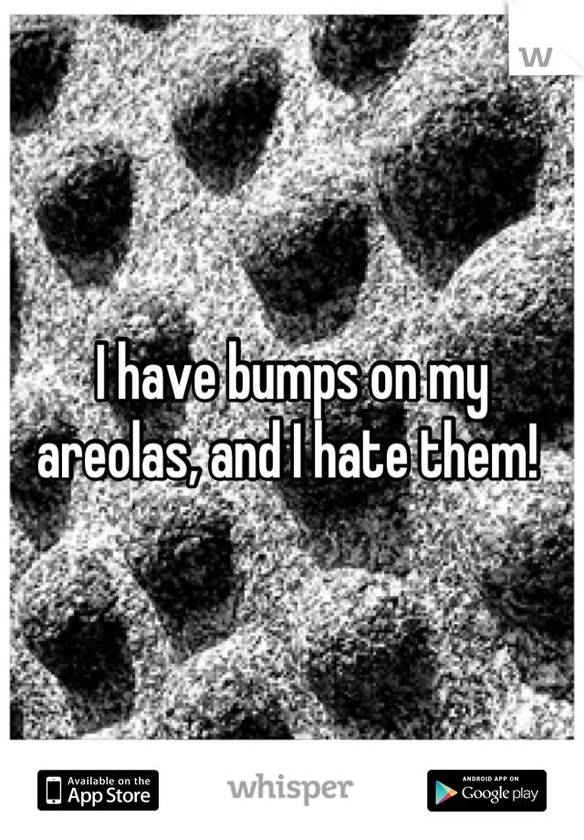 I have bumps on my areolas, and I hate them! 
