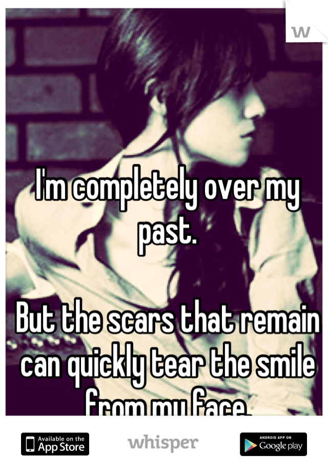 I'm completely over my past. 

But the scars that remain can quickly tear the smile from my face.