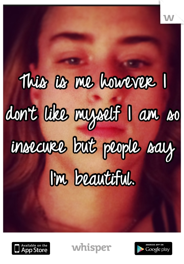 This is me however I don't like myself I am so insecure but people say I'm beautiful.