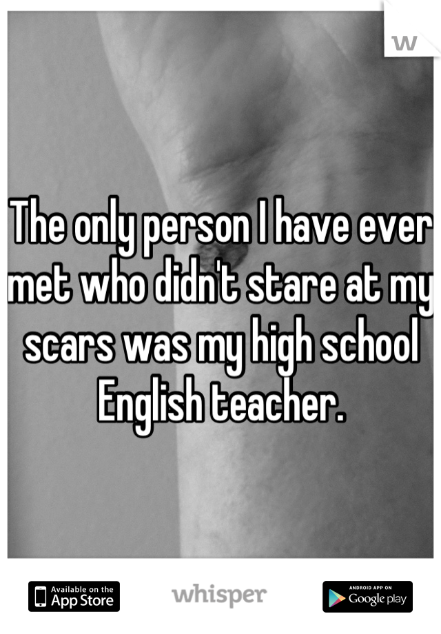 The only person I have ever met who didn't stare at my scars was my high school English teacher.