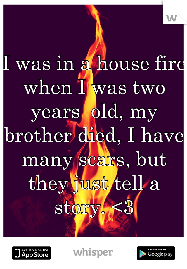I was in a house fire when I was two years  old, my brother died, I have many scars, but they just tell a story. <3