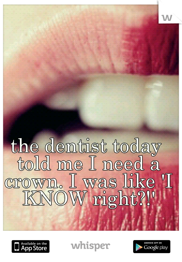 the dentist today told me I need a crown. I was like 'I KNOW right?!'