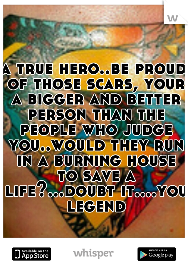 a true hero..be proud of those scars, your a bigger and better person than the people who judge you..would they run in a burning house to save a life?...doubt it....you legend