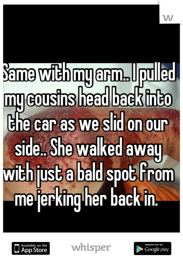 Same with my arm.. I pulled my cousins head back into the car as we slid on our side.. She walked away with just a bald spot from me jerking her back in. 