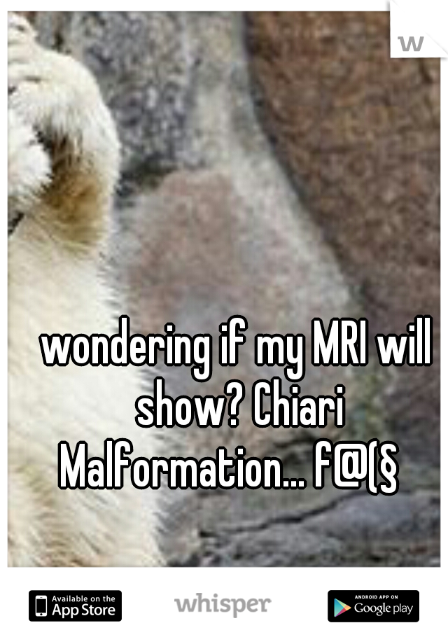 wondering if my MRI will show? Chiari Malformation... f@(§
