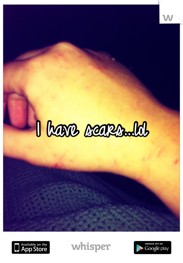 I have scars...lol